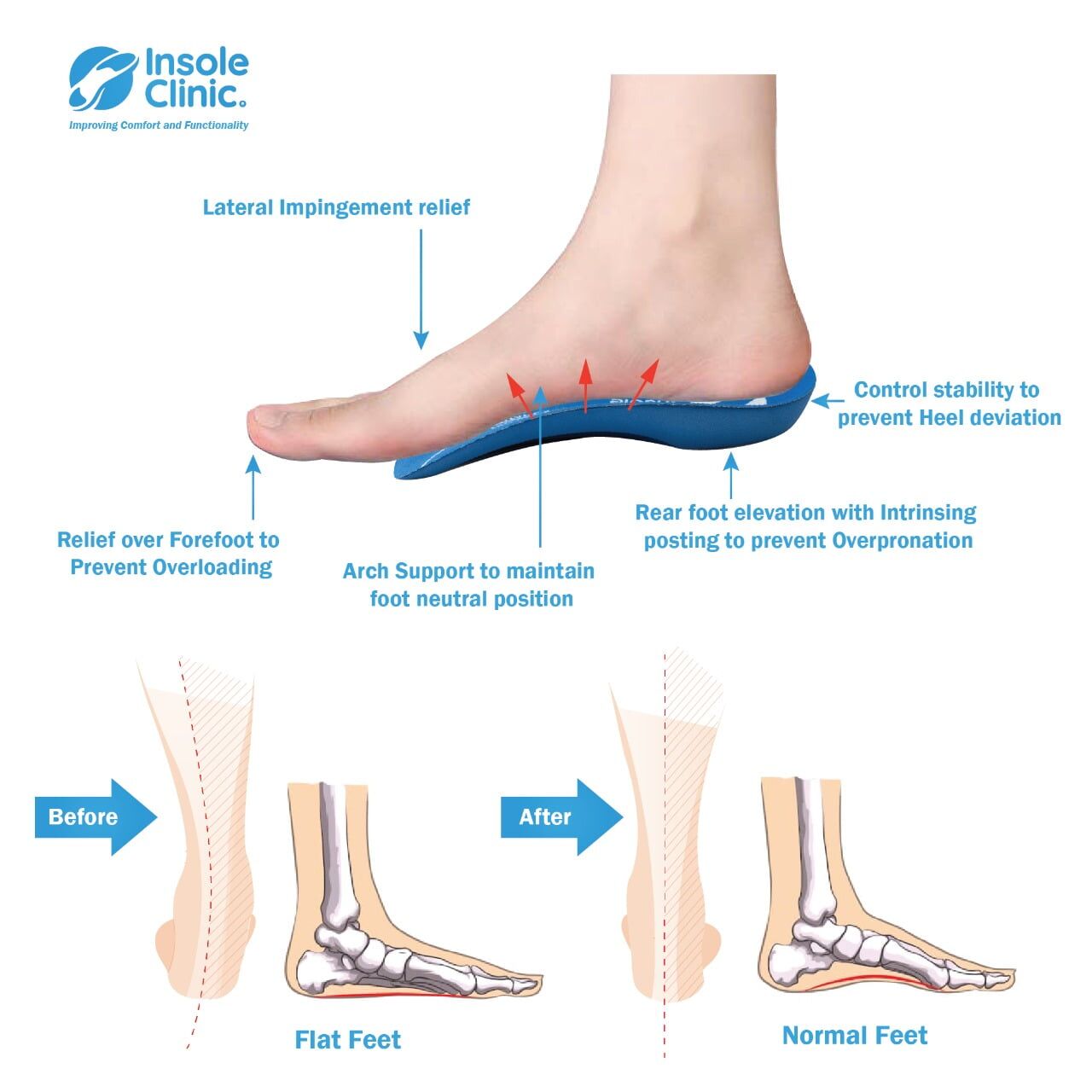 Arch support insoles on sale uk